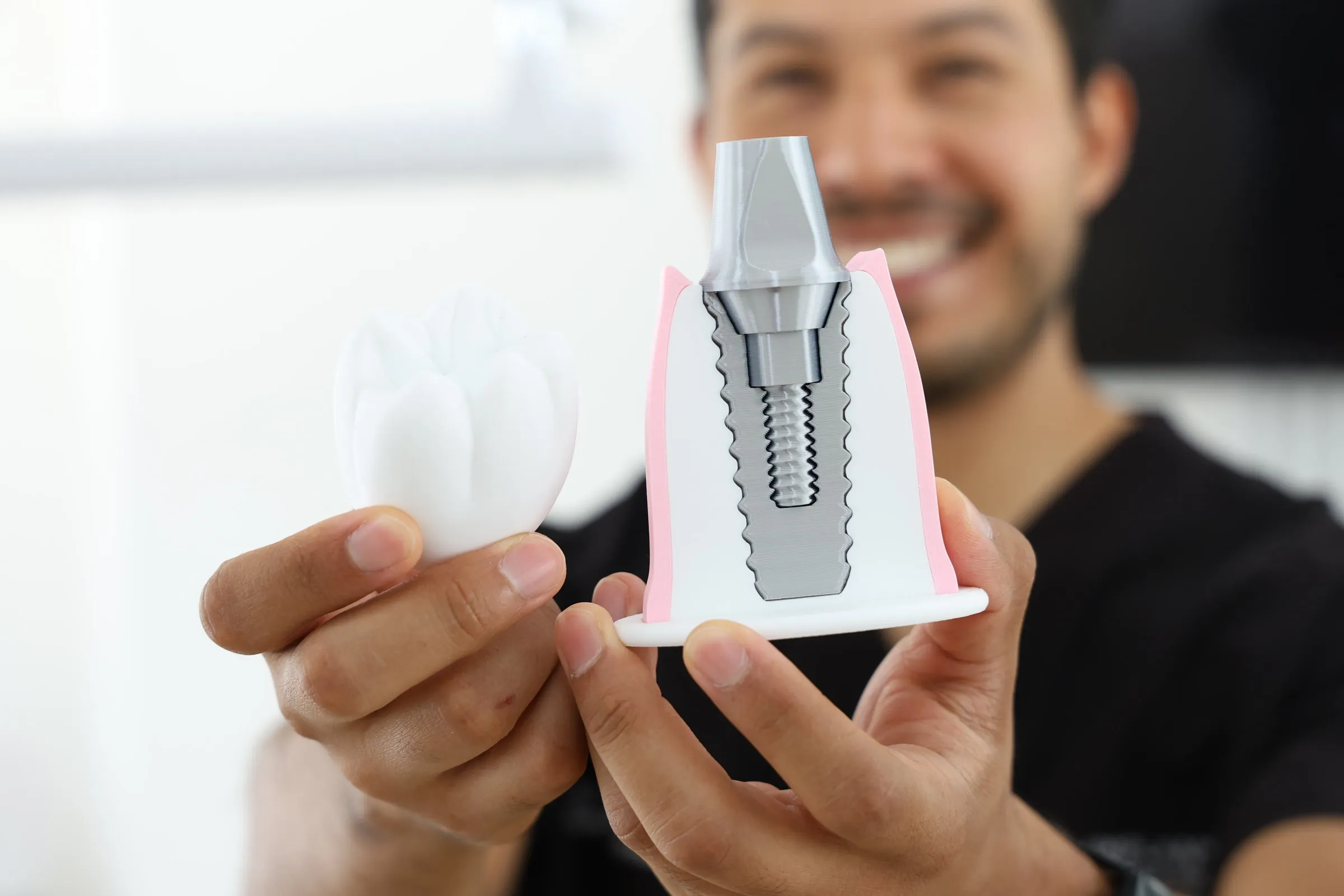 Modelo de implante dental en Implantec